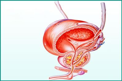 Prostatos uždegimas sergant ūminiu prostatitu yra sekso apribojimas