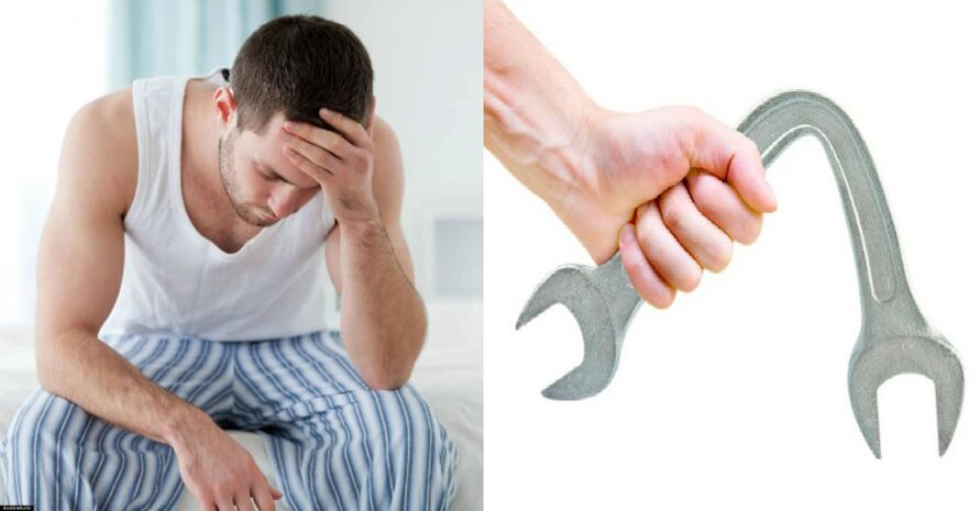 Prostatito simptomai